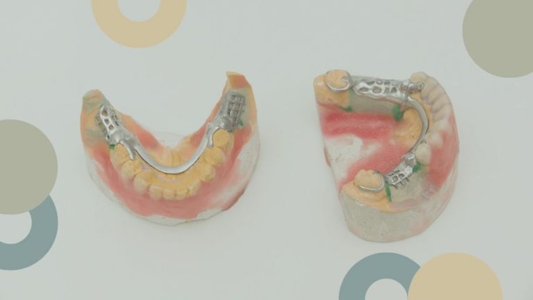prótesis dentales | Clínica Dental Sánchez Solís